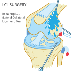 Surgery