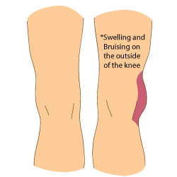 Signs & symptoms