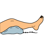 LCL Tear Treatment - Rest