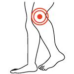 Symptoms of an LCL Tear Symptoms of an LCL Tear